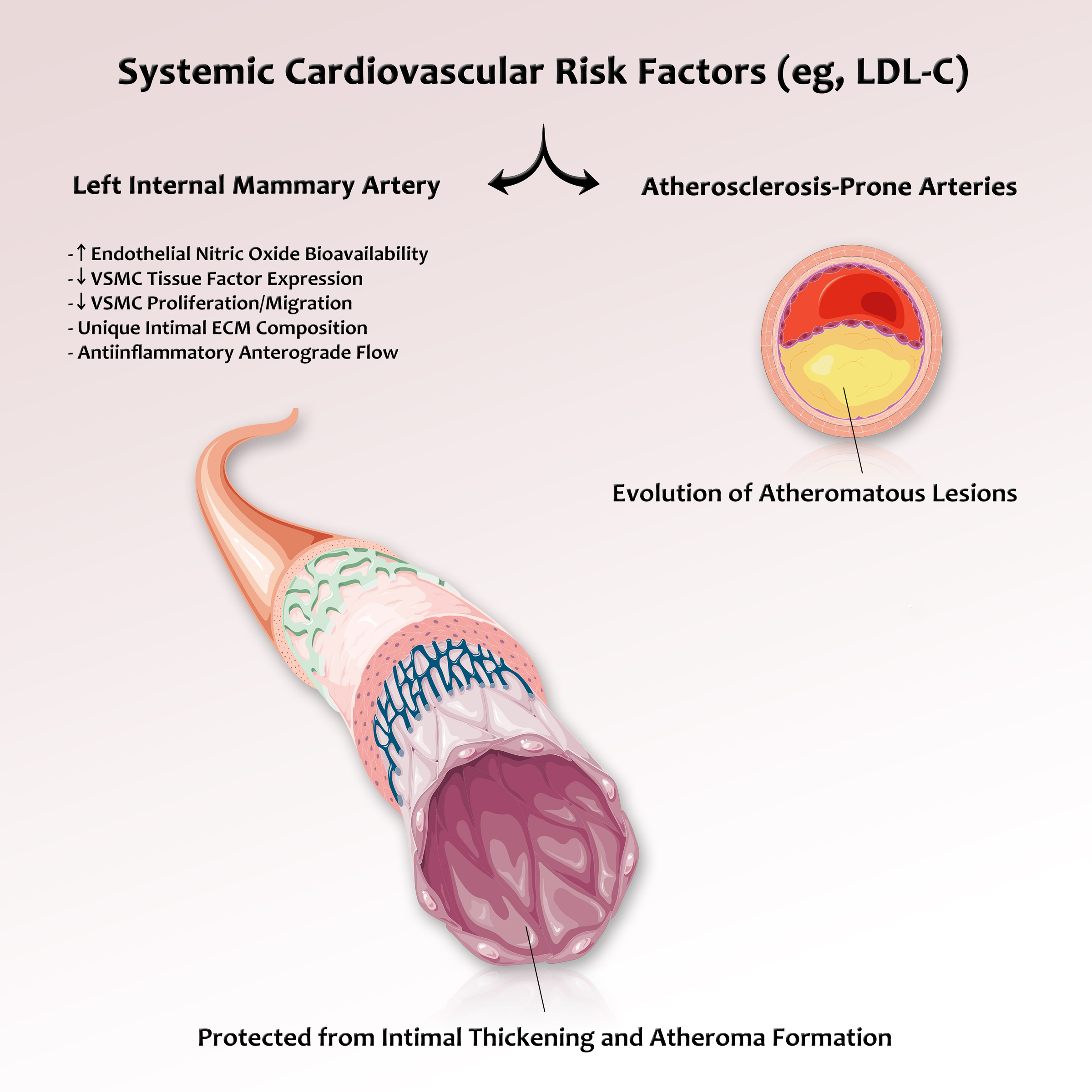 Systemic Cardiovascular Risk Factors (eg, LDL-C)